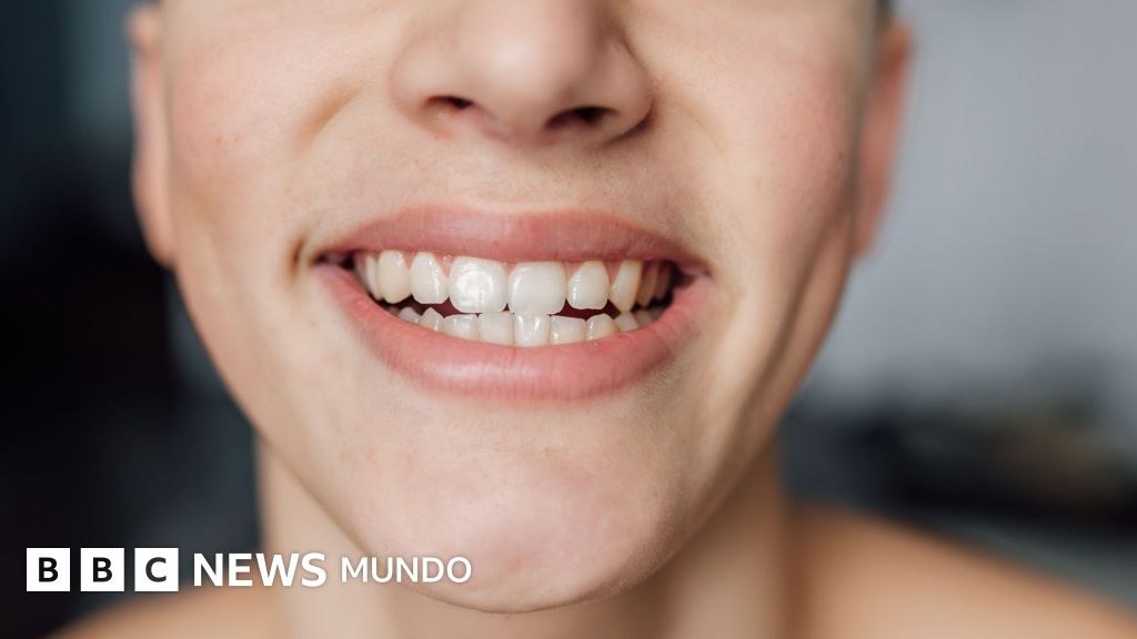 What You Should Eat to Protect the Good Bacteria in Your Mouth